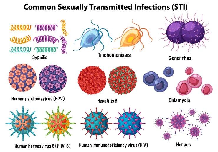 STI